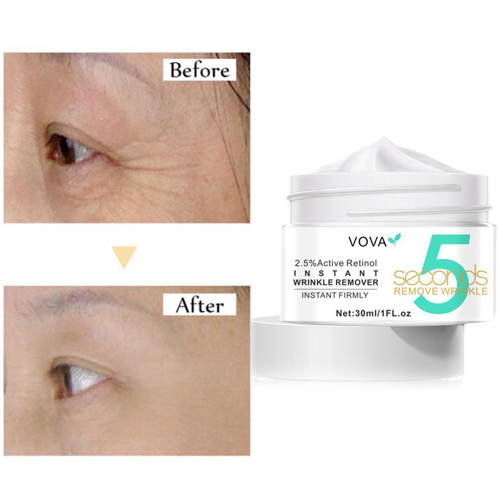 2.5% كريم عين الريتينول النشط  - مراجعة Milk Thistle Silymarin وسعره