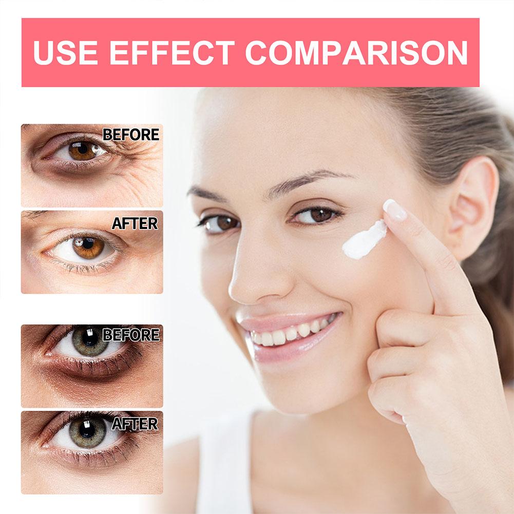 كريم العين بالريتينول لتفتيح ا - مراجعة Milk Thistle Silymarin وسعره